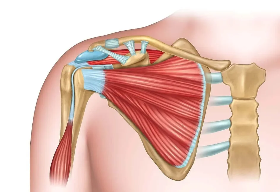 Ilustração de lesão do manguito rotador